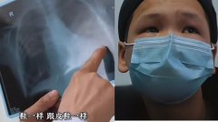男孩累到提不起书包 送医惊见心脏畸形如“鞋状”